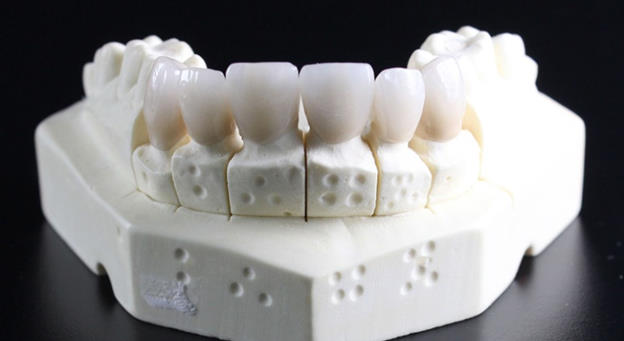 Rehabilitación oral